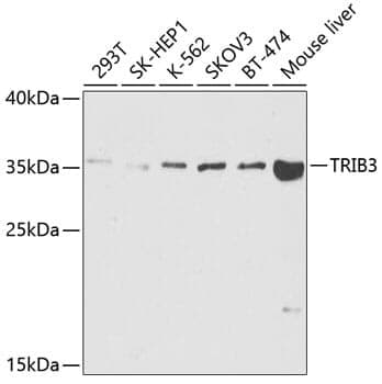 Anti-TRIB3 Antibody