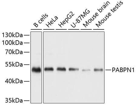Anti-PABPN1 Antibody