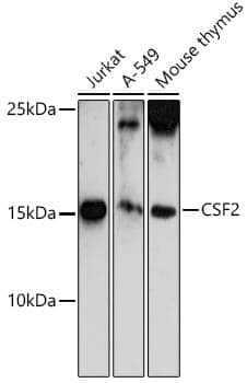 Anti-CSF2 Antibody