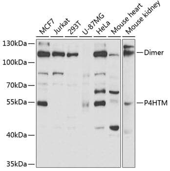 Anti-P4HTM Antibody