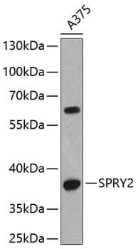 Anti-SPRY2 Antibody