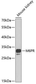 Anti-M6PR Antibody
