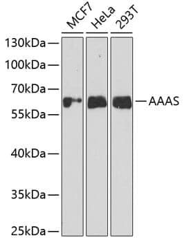 Anti-AAAS Antibody