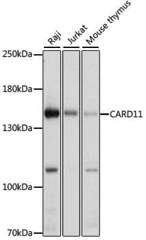 Anti-CARD11 Antibody