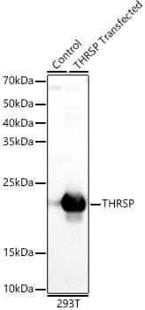 Anti-THRSP Antibody