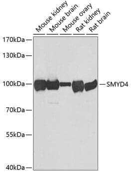 Anti-SMYD4 Antibody