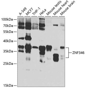 Anti-ZNF346 Antibody