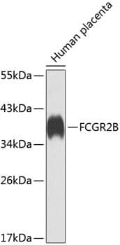 Anti-FCGR2B Antibody