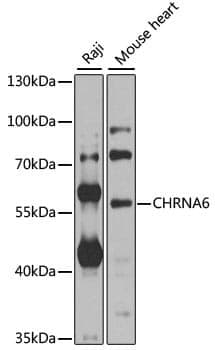 Anti-CHRNA6 Antibody