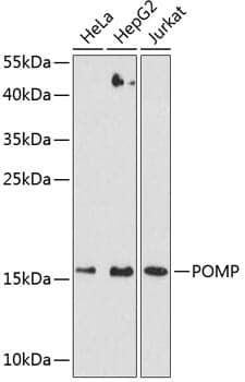 Anti-POMP Antibody