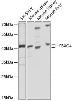Anti-FBXO4 Antibody