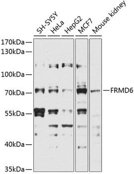 Anti-FRMD6 Antibody