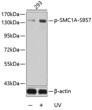 Anti-SMC1A (phospho S957) Antibody - Identical to Abcam (ab194759)
