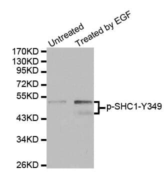 Anti-SHC1 (phospho Y349) Antibody - Identical to Abcam (ab194802)