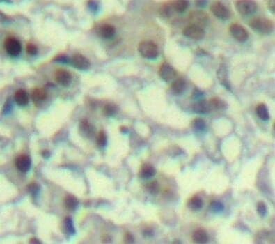 Anti-AURKA (phospho T288) Antibody