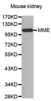 Anti-MME Antibody