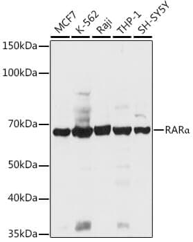 Anti-RARA Antibody