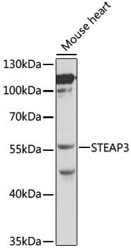 Anti-STEAP3 Antibody