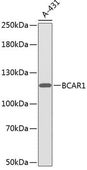 Anti-BCAR1 Antibody