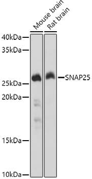 Anti-SNAP25 Antibody