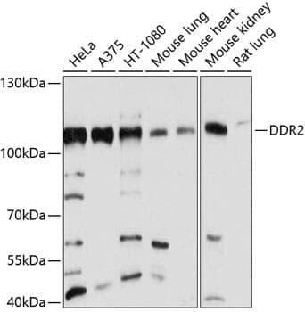 Anti-DDR2 Antibody