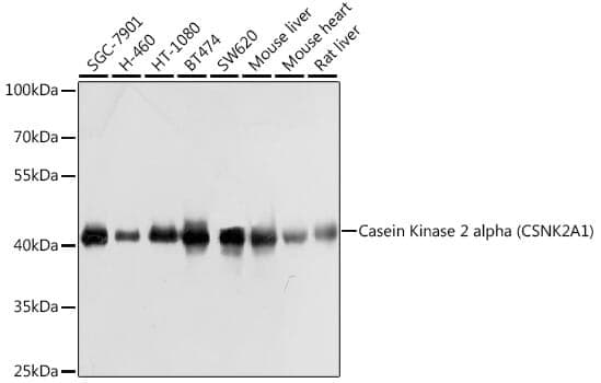 Anti-CSNK2A1 Antibody