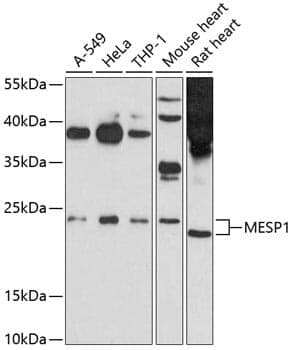 Anti-MESP1 Antibody