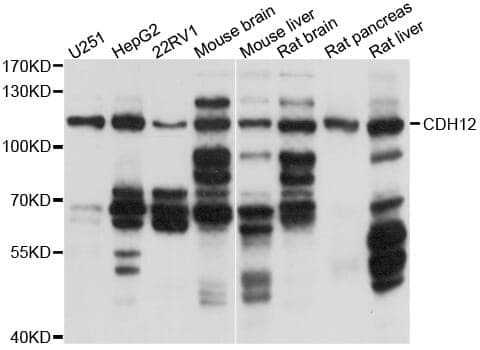 Anti-CDH12 Antibody