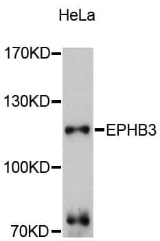 Anti-EPHB3 Antibody