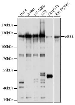 Anti-EIF3B Antibody
