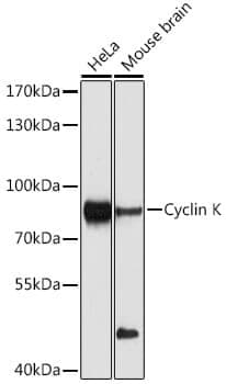 Anti-CCNK Antibody