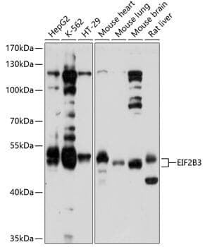 Anti-EIF2B3 Antibody