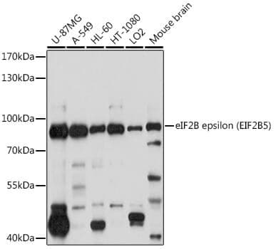 Anti-EIF2B5 Antibody