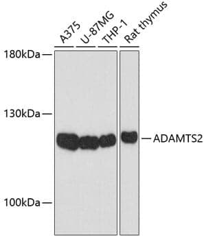 Anti-ADAMTS2 Antibody