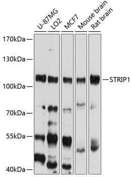 Anti-STRIP1 Antibody