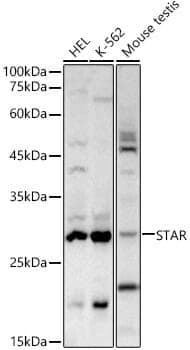 Anti-STAR Antibody