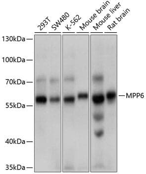Anti-MPP6 Antibody