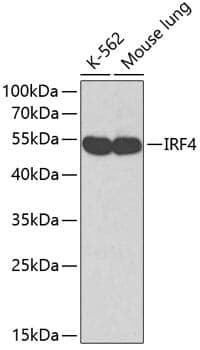 Anti-IRF4 Antibody