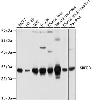 Anti-SRPRB Antibody