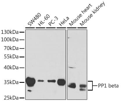 Anti-PPP1CB Antibody