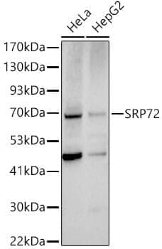 Anti-SRP72 Antibody