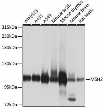 Anti-MSH2 Antibody