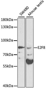 Anti-E2F8 Antibody