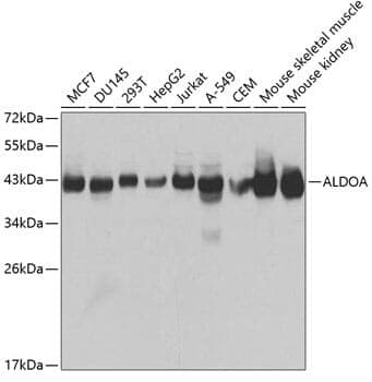 Anti-ALDOA Antibody