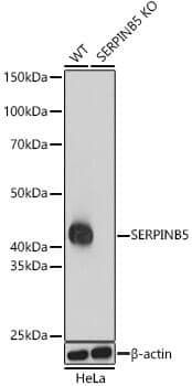 Anti-SERPINB5 Antibody