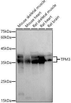 Anti-TPM3 Antibody - Identical to Abcam (ab180813)
