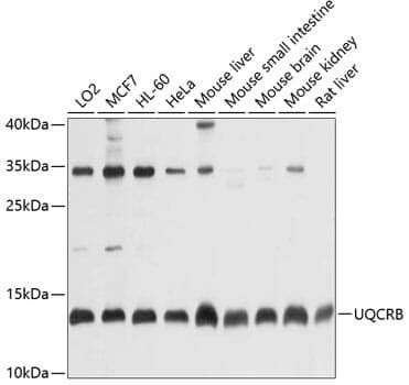 Anti-UQCRB Antibody
