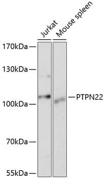 Anti-PTPN22 Antibody