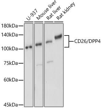 Anti-DPP4 Antibody