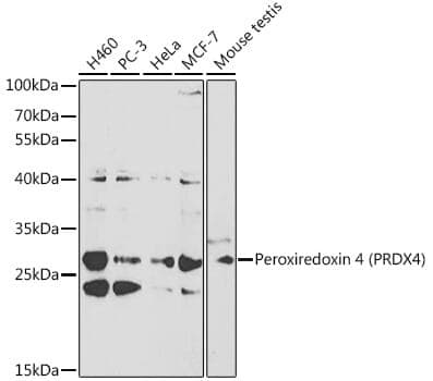 Anti-PRDX4 Antibody